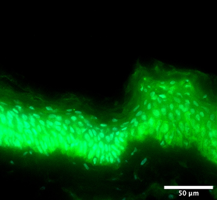 Condition stress + 1-LGVTY®
