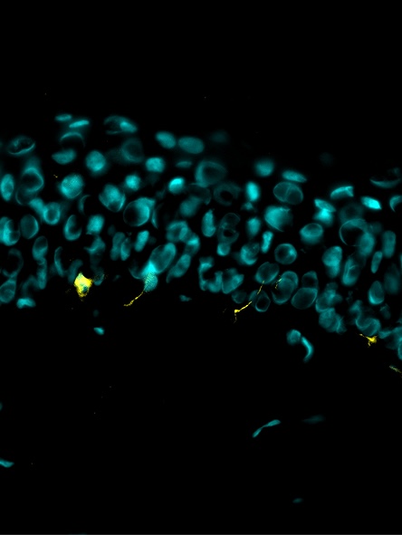 Condition stress + 1-LGVTY®