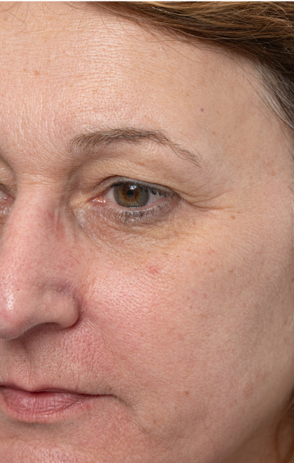 Image d’avant/après