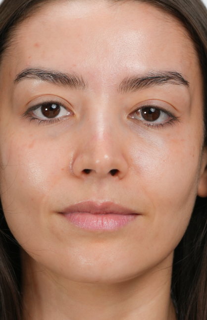 Image d’avant/après