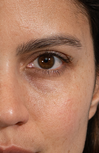 Image d’avant/après